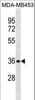 Polyclonal Rabbit anti-Human STX11 / Syntaxin 11 Antibody (aa29-56, WB)