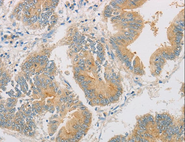 Polyclonal Rabbit anti-Human ZWINT Antibody (IHC)