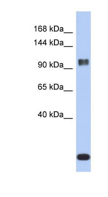 Polyclonal Rabbit anti-Human ATXN7 / SCA7 / Ataxin-7 Antibody (aa359-408, WB)