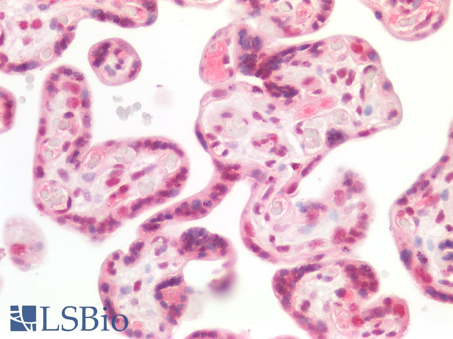 PathPlus™ SMARCB1 / INI1 Antibody