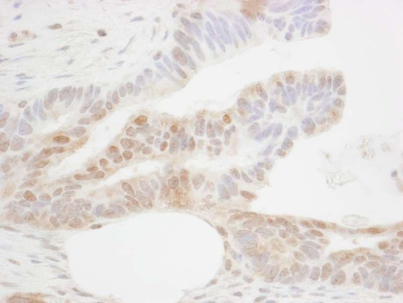 Polyclonal Rabbit anti-Human CDX2 Antibody (aa250-300, IHC)