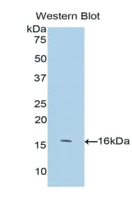 NF-L / NEFL Antibody (aa281-396, PE)