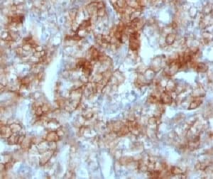 CDH16 / Cadherin 16 Antibody (clone KSCP2)