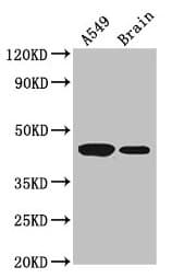 AMT Antibody