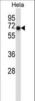 ALK2 / ACVR1 Antibody (aa137-166)