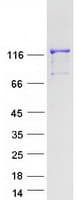 Human PRPF40B Protein (Recombinant Myc-DDK (Flag))