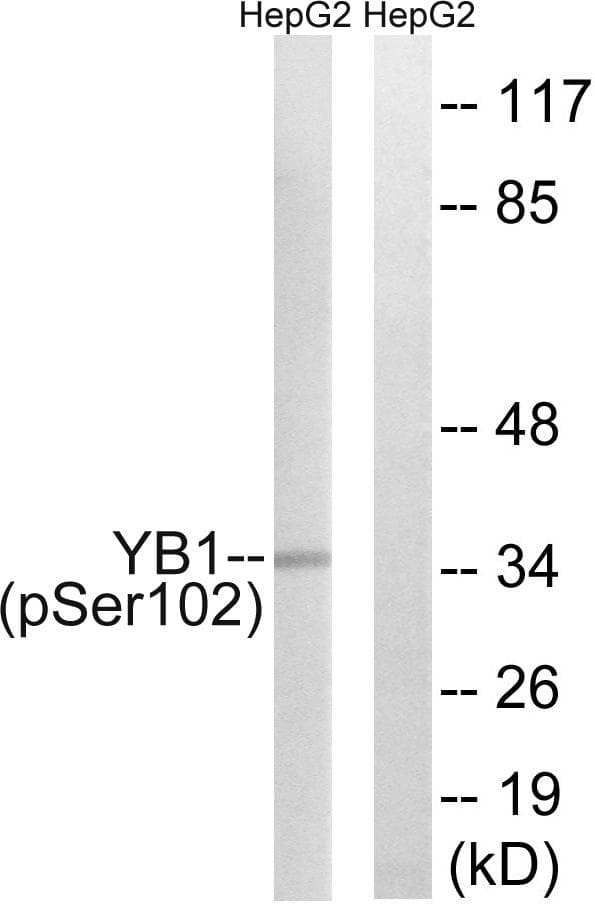 YBX1 / YB1 Antibody (phospho-Ser102)
