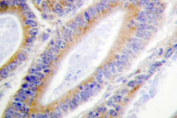 Polyclonal Rabbit anti-Human CSNK1A1 / CK1 Alpha Antibody (Gln317, IHC, IF, WB)