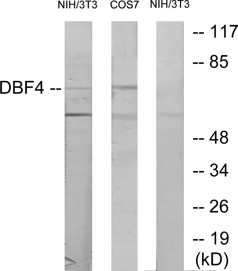 Polyclonal Rabbit anti-Human DBF4 Antibody (aa10-59, WB)