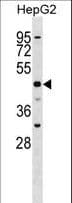 SLC2A9 / GLUT9 Antibody (aa75-104)
