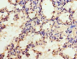 EZH1 / ENX-2 Antibody