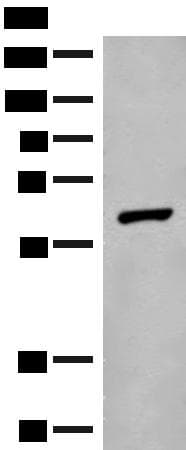 Polyclonal Rabbit anti-Human GLS2 / Glutaminase 2 Antibody (IHC, WB)