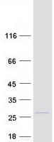 Human MAX Protein (Recombinant Myc-DDK (Flag))