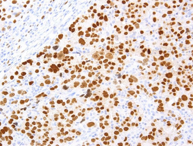 PAX8 Antibody (clone AHC0210, Ready-to-Use)