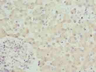 Polyclonal Rabbit anti-Human SPCS3 Antibody (IHC)