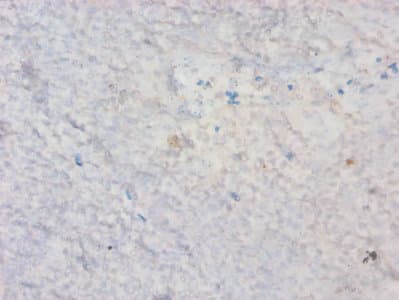 HAVCR2 / TIM-3 Antibody