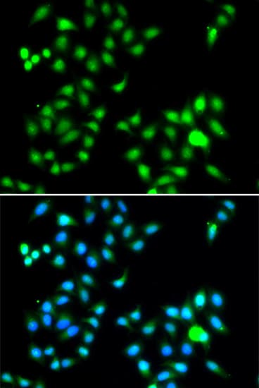 TWIST1 / TWIST Antibody