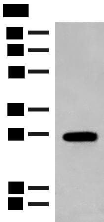 Polyclonal Rabbit anti-Human GCAP2 / GUCA1B Antibody (IHC, WB)