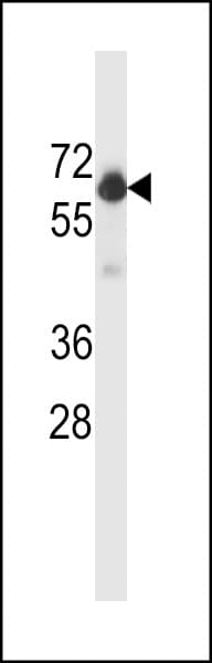 BECN1 / Beclin-1 Antibody (aa100-123)