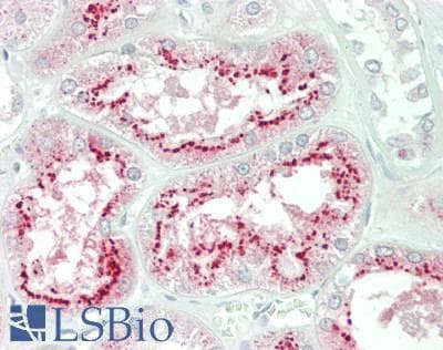 IHC-plus™ SMIF / DCP1A Antibody (aa532-582)