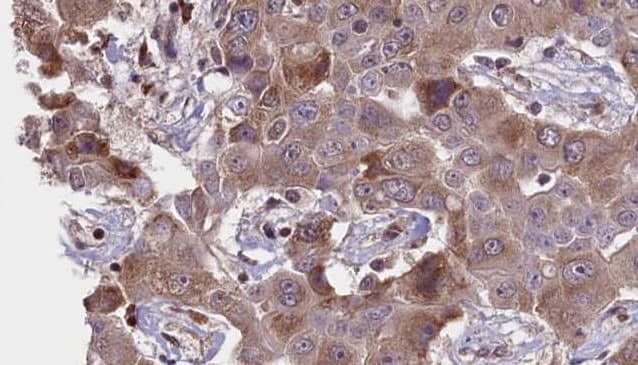PRKAR1A Antibody
