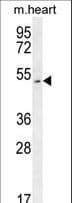 Polyclonal Rabbit anti-Human SLC10A4 Antibody (aa370-398, WB)