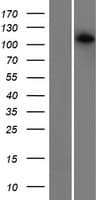 CDCA2 Protein (Over-Expression Lysate Myc-DDK (Flag))