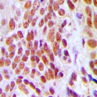 HMG2 / HMGB2 Antibody (Internal)