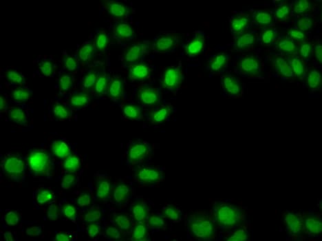 SULT2B1 / Sulfotransferase 2B1 Antibody