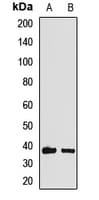 HOXA11 Antibody