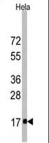 Fragilis / IFITM3 Antibody (aa64-93)