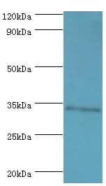 Polyclonal Rabbit anti-Human M-PST / STM Antibody (aa1-295, IHC, WB)
