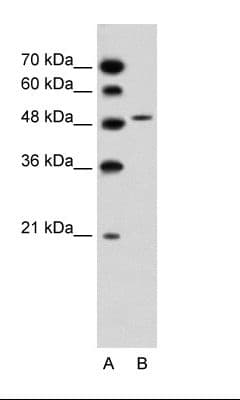 Polyclonal Rabbit anti-Human SLC10A5 Antibody (aa351-400, IHC, WB)