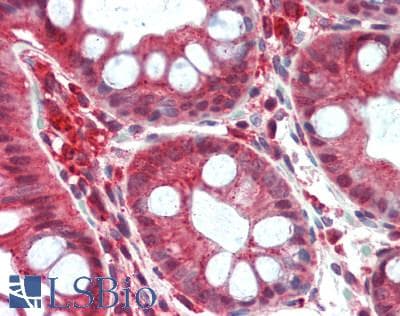 UVRAG Antibody (aa375-425)