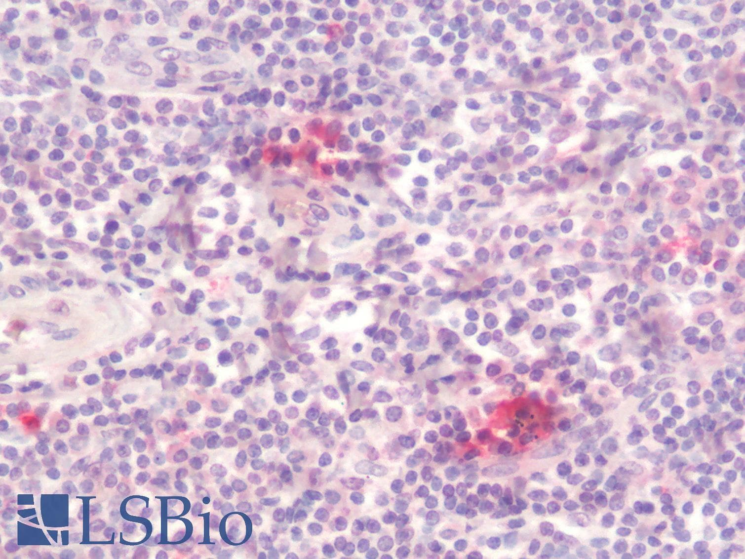 IHC-plus™ LAG3 Antibody