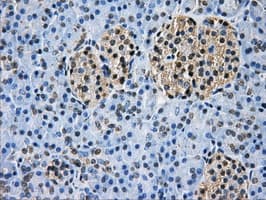 GBE1 Antibody (clone OTI5B7)
