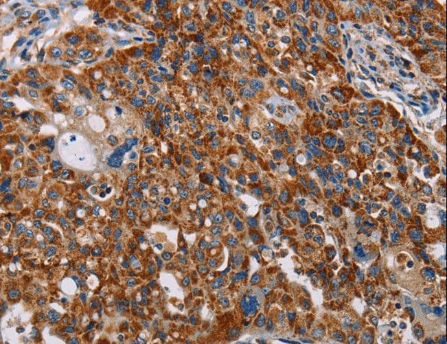 ALG2 Antibody