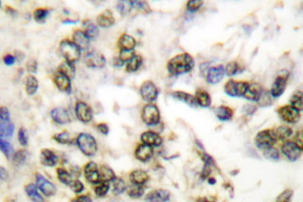 Polyclonal Rabbit anti-Human PARK7 / DJ-1 Antibody (Pro54, IHC, IF, WB)