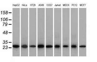EMG1 / NEP1 Antibody (clone OTI1B8)