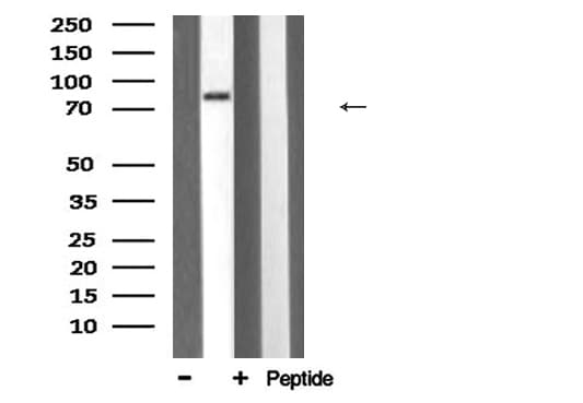 Polyclonal Rabbit anti-Human HSP90B1 / GP96 / GRP94 Antibody (IHC, IF, WB)