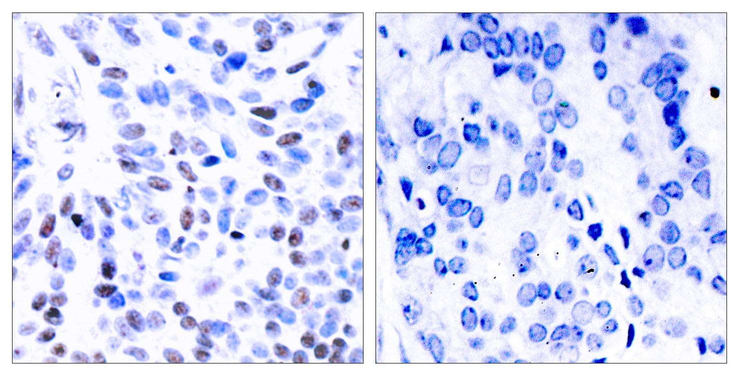 NFKB2 Antibody (p865)