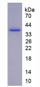 Rat TH / Tyrosine Hydroxylase Protein (Recombinant His-S)