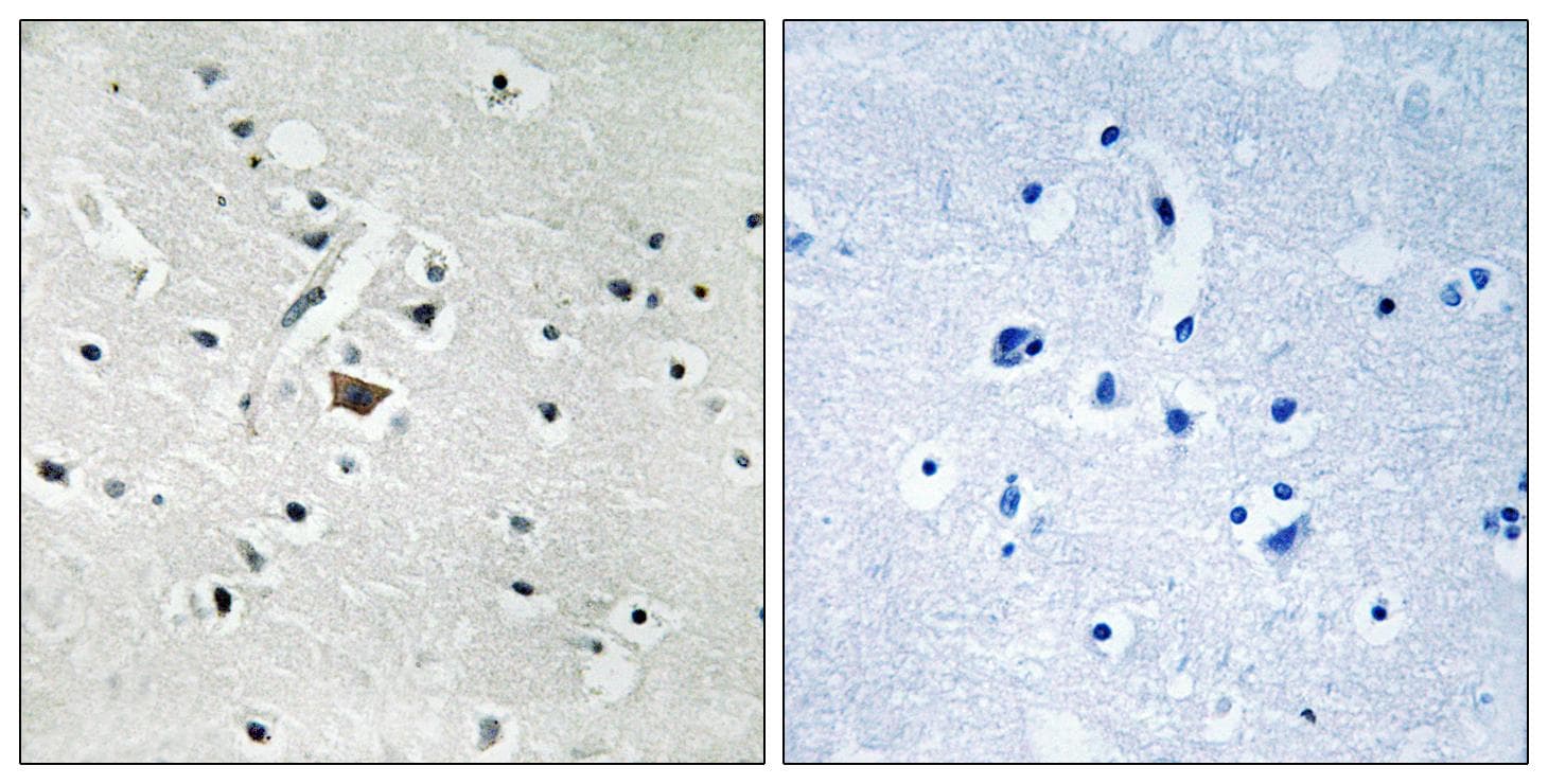 PLD2 / Phospholipase D2 Antibody (phospho-Tyr169)