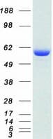 Human USP14 Protein (Recombinant Myc-DDK (Flag))