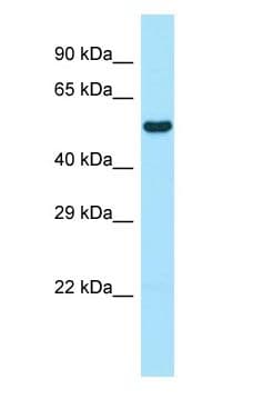 Polyclonal Rabbit anti-Rat WIPF1 / WIP Antibody (N-Terminus, WB)