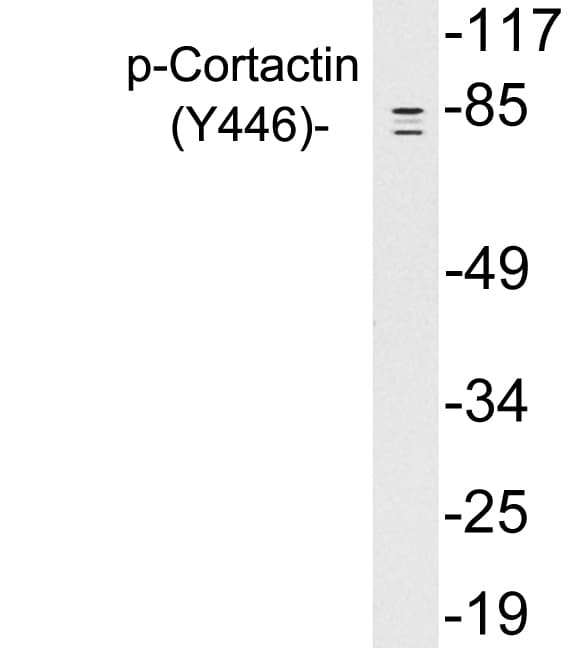 CTTN / Cortactin Antibody (phospho-Tyr446)