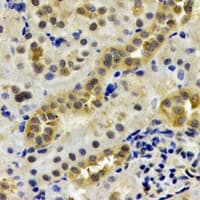 IHC-plus™ Polyclonal Rabbit anti-Human LAP3 Antibody (IHC, WB)