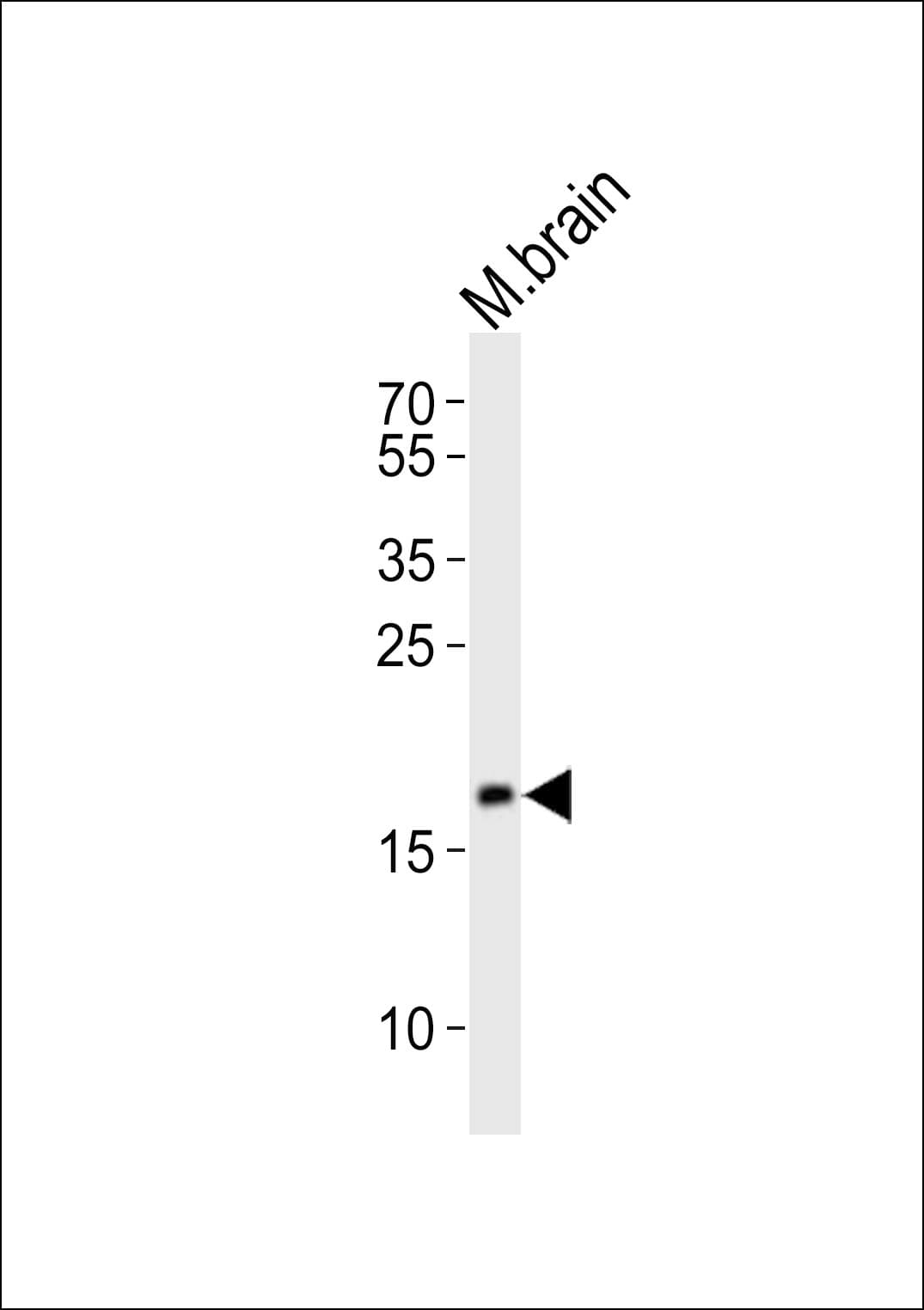 Polyclonal Rabbit anti-Human FAM168B Antibody (aa165-199, WB)