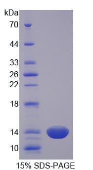 Human CRIP1 Protein (Recombinant His-T7)