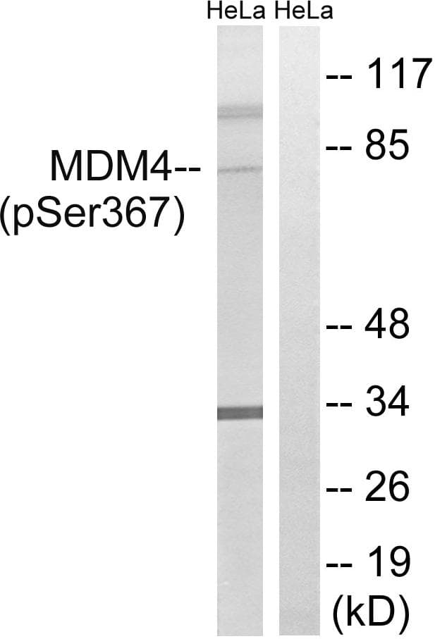 MDM4 / MDMX Antibody (phospho-Ser367)